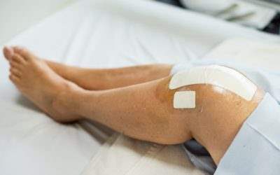 Can I Sue if My Knee Replacement Gets Infected?