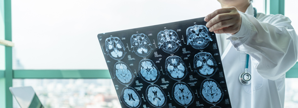 A doctor reviewing CT scan of a brain injury after an accident